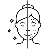 Kezelés